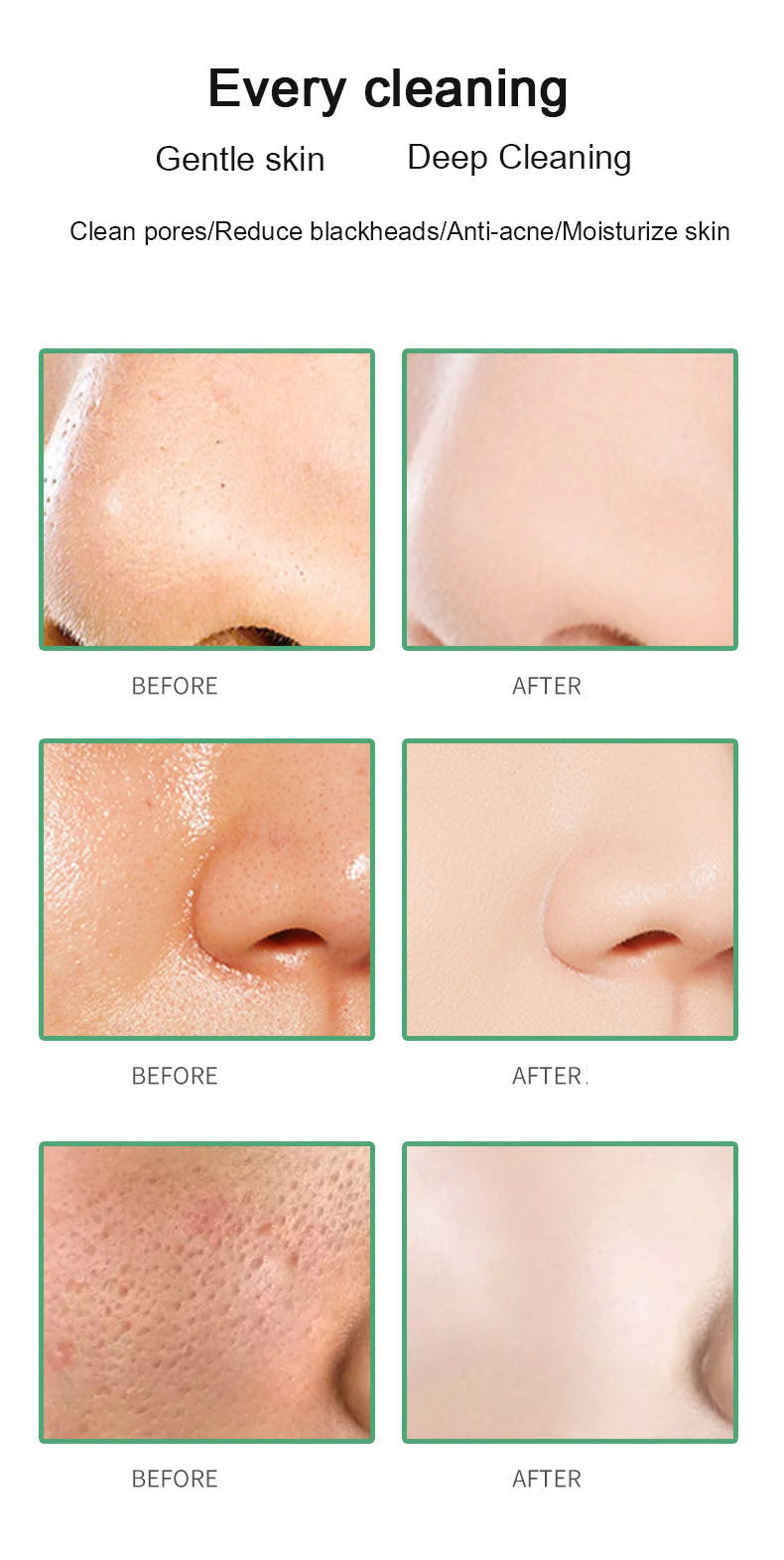 Multi- Functional Blackhead Remover