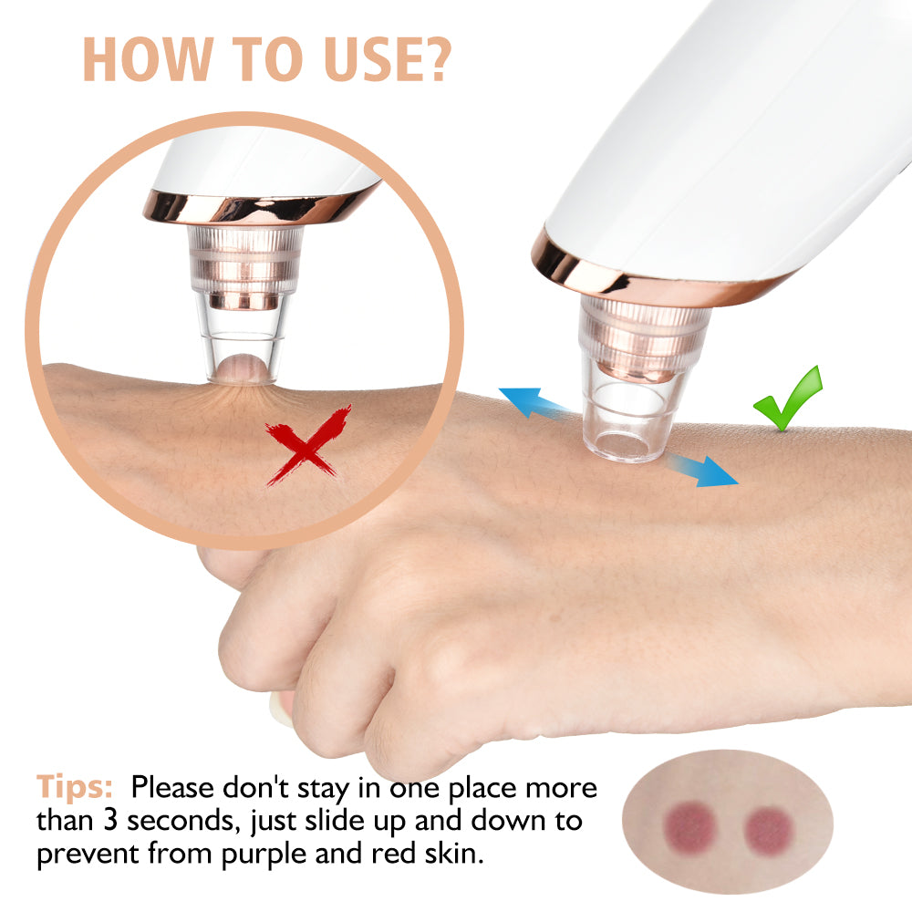 Multi- Functional Blackhead Remover